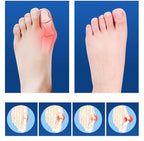 Big Toe Corrector