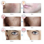 GlowRevive LED Light Therapy Face Mask